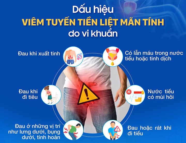 Viêm tuyến tiền liệt: Dấu hiệu, biến chứng và cách điều trị 2 dau hieu viem tuyen tien liet