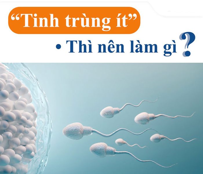Tinh trùng ít: Nguyên nhân, dấu hiệu nhận biết và cách cải thiện 1 tinh trung it