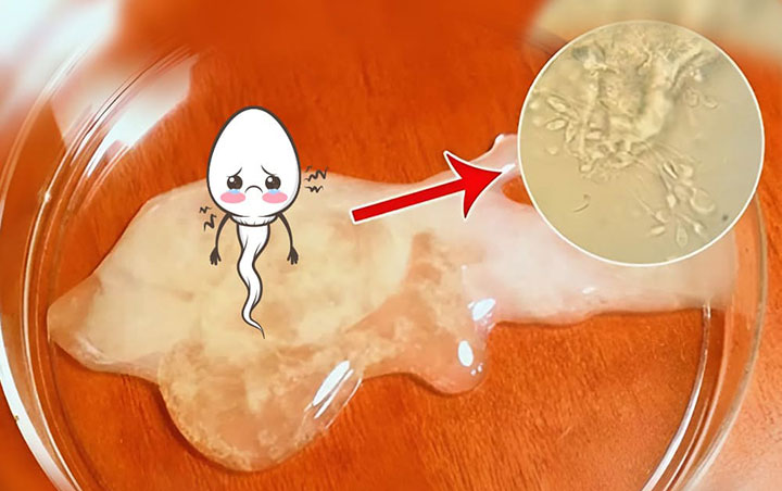 Tinh trùng yếu: Nguyên nhân, dấu hiệu nhận biết và cách cải thiện 1 tinh trung yeu