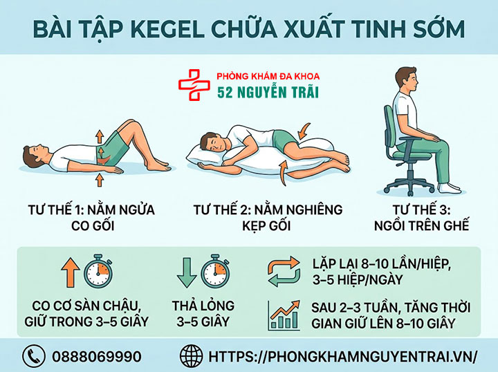 Cách chữa xuất tinh sớm tại nhà không dùng thuốc hiệu quả 1 Bài tập Kegel
