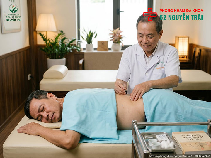 Bài thuốc dân gian, thảo dược chữa phì đại tiền liệt tuyến 3 Bấm huyệt, châm cứu