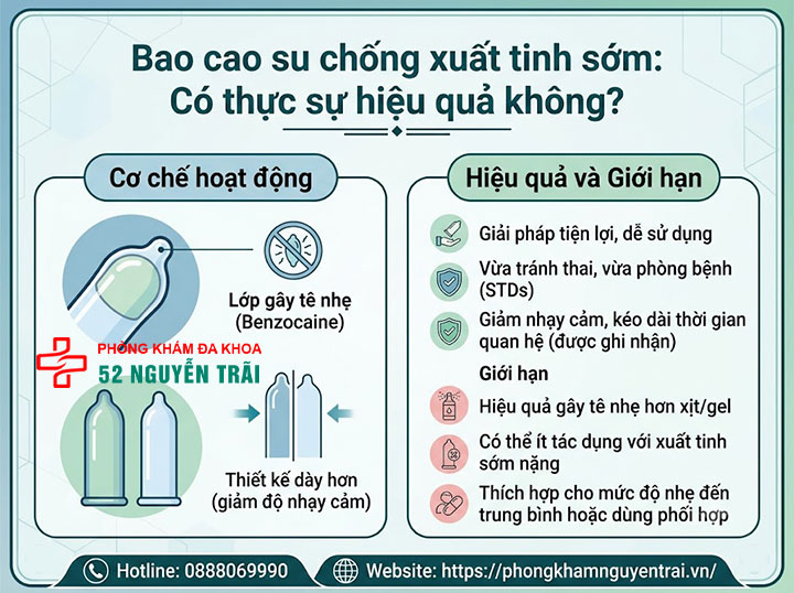 Gel , vòng đeo, chai xịt chống xuất tinh sớm: Loại nào tốt? 3 Bao cao su chống xuất tinh sớm: Có thực sự hiệu quả không?