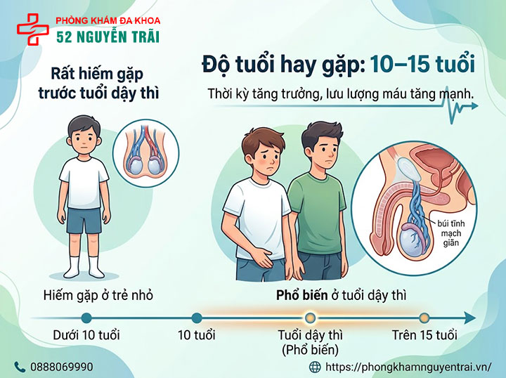 Giãn Tĩnh Mạch Thừng Tinh Ở Trẻ Em: Cha Mẹ Cần Biết Gì? 1 Bao nhiêu tuổi thì dễ bị giãn tĩnh mạch thừng tinh? Độ tuổi hay gặp