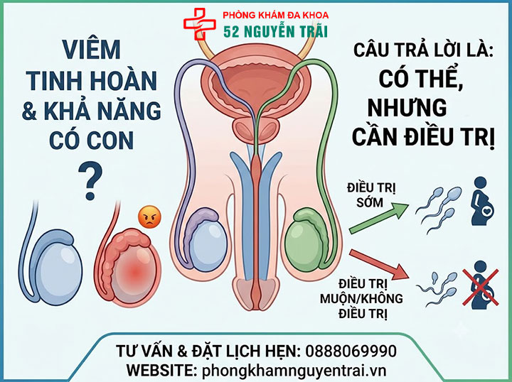 Viêm Tinh Hoàn Có Nguy Hiểm Không? Biến Chứng Cần Biết 3 Bị Viêm Tinh Hoàn Có Con Được Không?