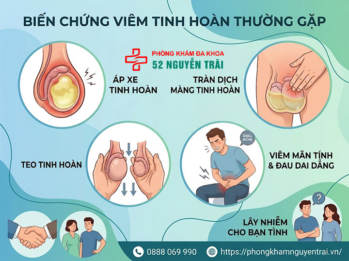 Viêm Tinh Hoàn Có Nguy Hiểm Không? Biến Chứng Cần Biết 2 Biến Chứng Viêm Tinh Hoàn Thường Gặp