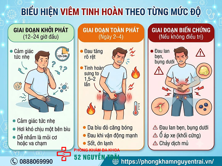 Dấu Hiệu, Triệu Chứng Viêm Tinh Hoàn Cần Biết Sớm 2 Biểu Hiện Viêm Tinh Hoàn Theo Từng Mức Độ