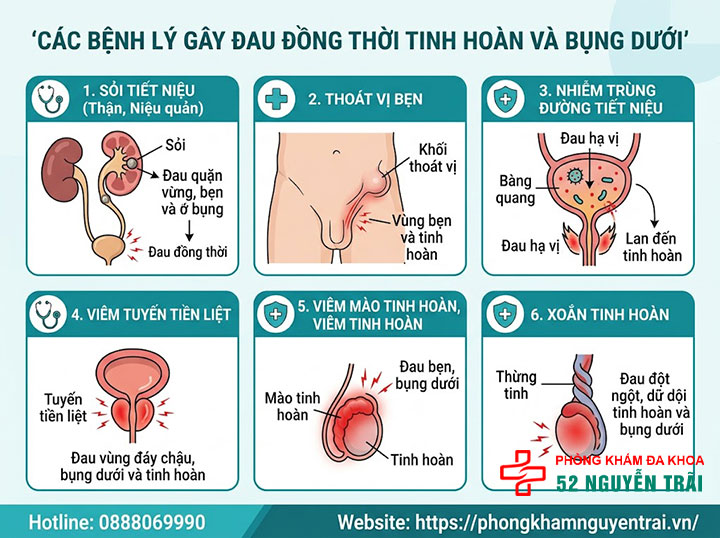 Đau Tinh Hoàn Và Bụng Dưới: Liên Hệ Và Cách Xử Lý 2 Các bệnh lý gây đau đồng thời tinh hoàn và bụng dưới