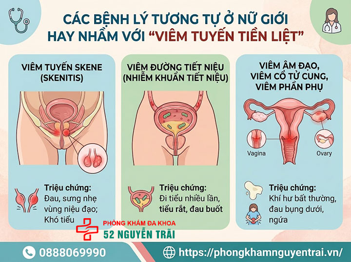 Viêm tuyến tiền liệt ở nữ giới: Sự thật y khoa 3 Các bệnh lý tương tự ở nữ giới mà người bệnh thường nhầm là "viêm tuyến tiền liệt"