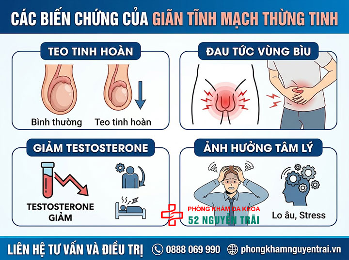 Giãn Tĩnh Mạch Thừng Tinh Có Nguy Hiểm Không? 4 Các biến chứng giãn tĩnh mạch thừng tinh khác cần lưu ý