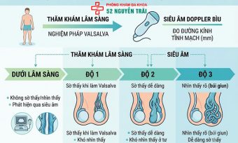 4 cấp độ giãn tĩnh mạch thừng tinh – Phân biệt độ 1, 2, 3 và dưới lâm sàng
