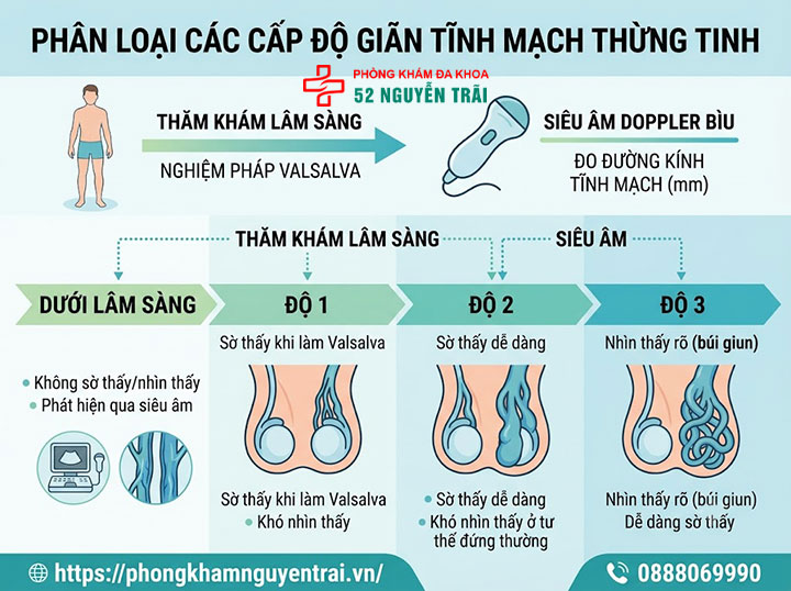 4 cấp độ giãn tĩnh mạch thừng tinh – Phân biệt độ 1, 2, 3 và dưới lâm sàng 1 Các cấp độ giãn tĩnh mạch thừng tinh được phân loại dựa trên cơ sở nào?