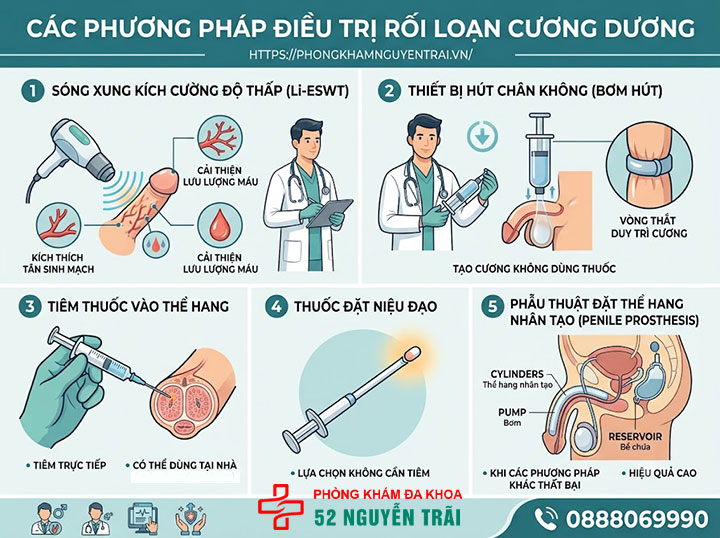 Khám rối loạn cương dương ở đâu tốt tại Hà Nội? 3 Các phương pháp điều trị rối loạn cương dương