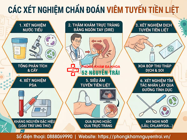 Khám viêm tuyến tiền liệt ở đâu? Chi phí bao nhiêu? 2 Các xét nghiệm chẩn đoán viêm tuyến tiền liệt