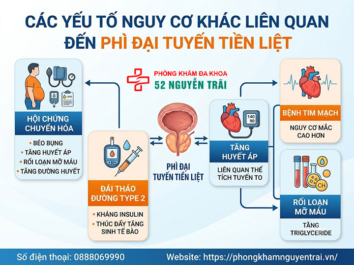 Nguyên nhân gây phì đại tuyến tiền liệt ở nam giới 4 Các yếu tố nguy cơ khác liên quan đến phì đại tuyến tiền liệt