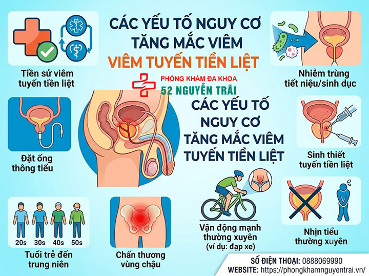 Nguyên nhân gây viêm tuyến tiền liệt ở nam giới 3 Các yếu tố nguy cơ làm tăng khả năng mắc bệnh viêm tuyến tiền liệt