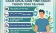 Cách chữa giãn tĩnh mạch thừng tinh tại nhà có hiệu quả?
