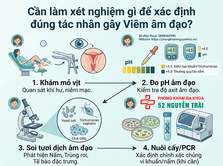 Viêm âm đạo do nấm Candida, Gardnerella, Trichomonas: Phân biệt và điều trị 6 Cần làm xét nghiệm gì để xác định đúng tác nhân gây Viêm âm đạo?