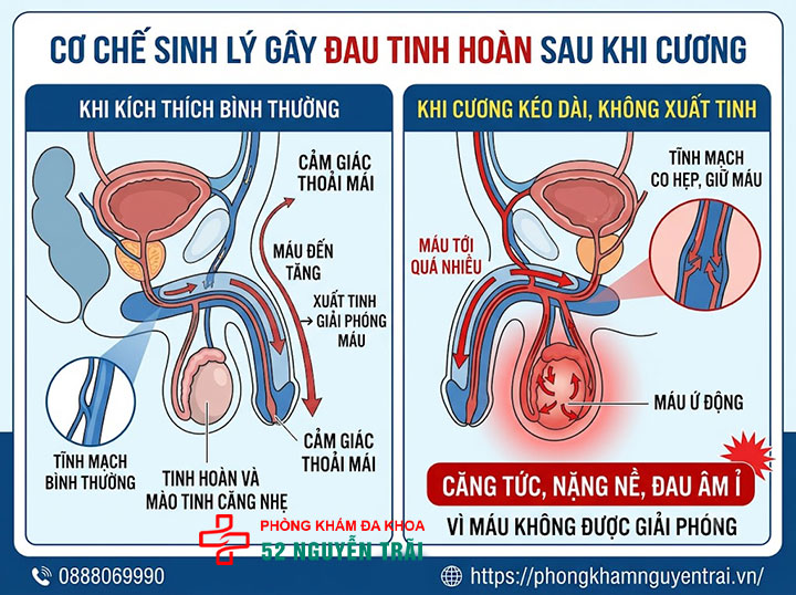 Đau Tinh Hoàn Sau Khi Cương: Nguyên Nhân, Cách Xử Lý 1 Cơ chế sinh lý gây đau tinh hoàn sau khi cương
