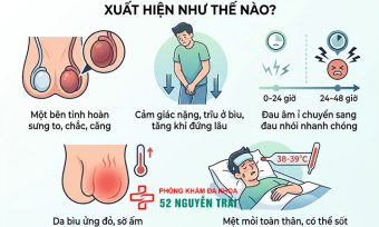 Dấu Hiệu, Triệu Chứng Viêm Tinh Hoàn Cần Biết Sớm