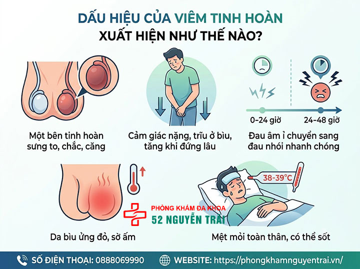 Dấu Hiệu, Triệu Chứng Viêm Tinh Hoàn Cần Biết Sớm 1 Dấu Hiệu Của Viêm Tinh Hoàn Xuất Hiện Như Thế Nào