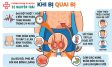 Viêm Tinh Hoàn Do Quai Bị: Triệu Chứng Và Cách Điều Trị
