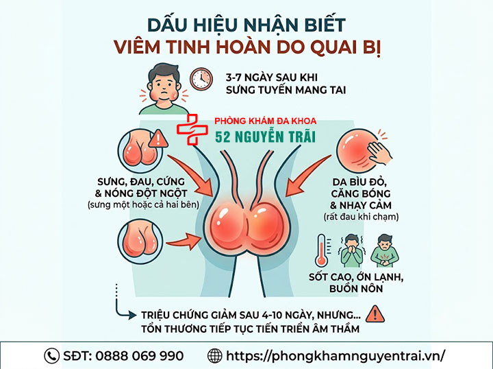 Quai bị đau tinh hoàn: Biến chứng nguy hiểm cần biết 3 Dấu hiệu nhận biết viêm tinh hoàn do quai bị