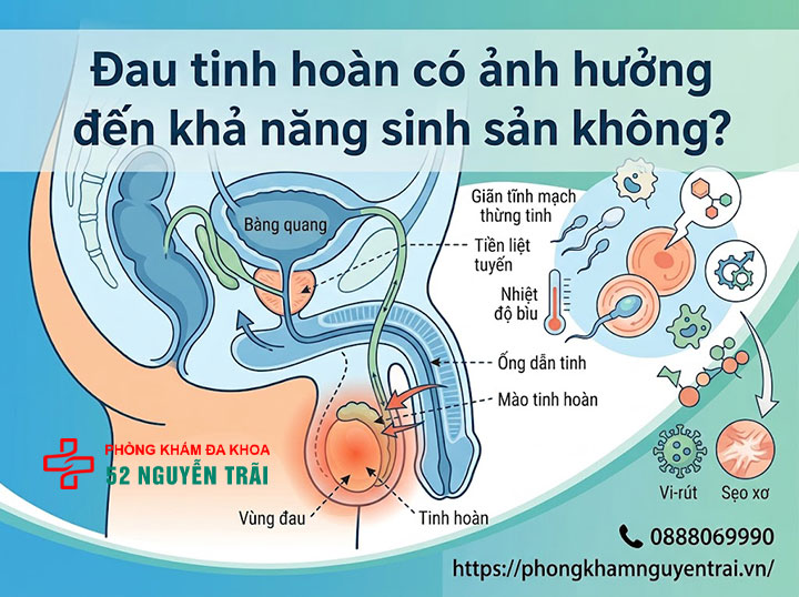 Đau Tinh Hoàn Có Nguy Hiểm Không? Dấu Hiệu Cấp Cứu 5 Đau tinh hoàn có ảnh hưởng đến khả năng sinh sản không?