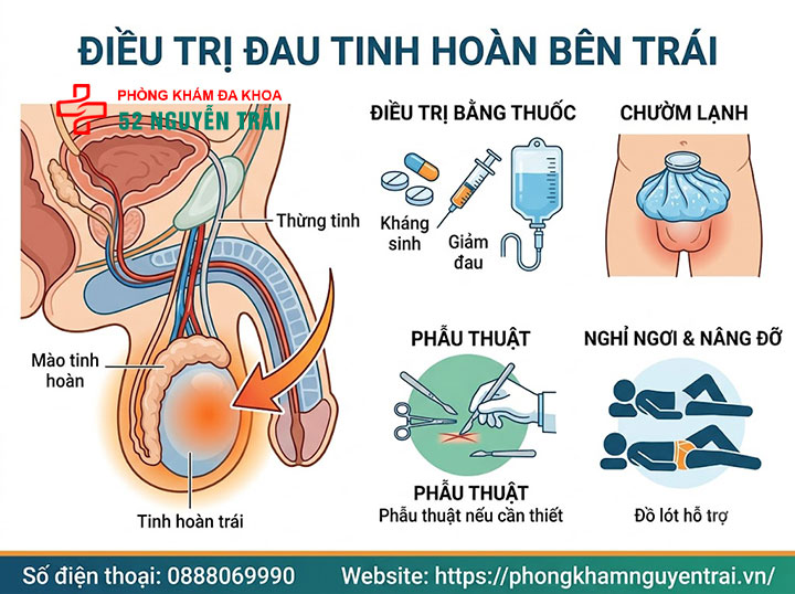 Đau Tinh Hoàn Bên Trái: Nguyên Nhân Và Cách Điều Trị 7 Điều trị đau tinh hoàn bên trái theo từng nguyên nhân