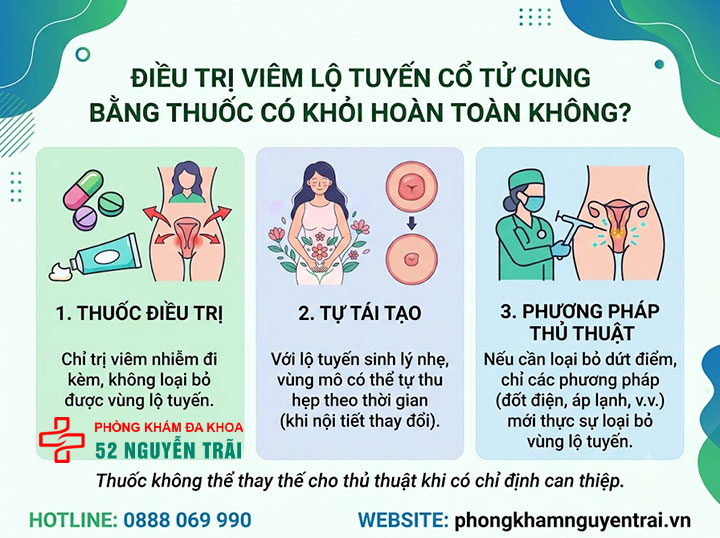 Điều Trị Viêm Lộ Tuyến Cổ Tử Cung: Thuốc Và Phác Đồ 5 Điều trị viêm lộ tuyến cổ tử cung bằng thuốc có khỏi hoàn toàn không?