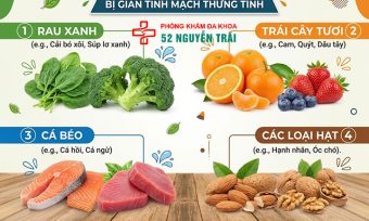 Giãn Tĩnh Mạch Thừng Tinh Nên Kiêng Gì? Lối Sống Đúng