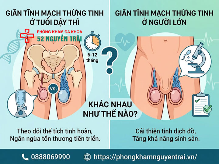 Giãn Tĩnh Mạch Thừng Tinh Ở Trẻ Em: Cha Mẹ Cần Biết Gì? 2 Giãn tĩnh mạch thừng tinh ở tuổi dậy thì khác gì so với người lớn?