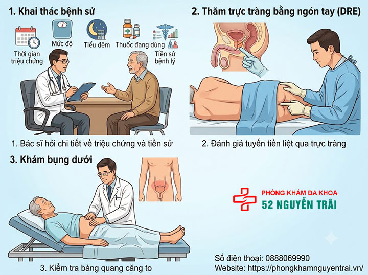 Chẩn đoán phì đại tuyến tiền liệt: Siêu âm, xét nghiệm 1 Khám lâm sàng, thăm trực tràng