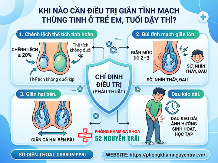 Giãn Tĩnh Mạch Thừng Tinh Ở Trẻ Em: Cha Mẹ Cần Biết Gì? 3 Khi nào cần điều trị giãn tĩnh mạch thừng tinh ở trẻ em, tuổi dậy thì?