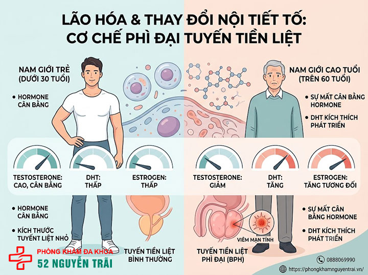 Nguyên nhân gây phì đại tuyến tiền liệt ở nam giới 1 Lão hóa và thay đổi nội tiết tố (testosterone, DHT, estrogen)