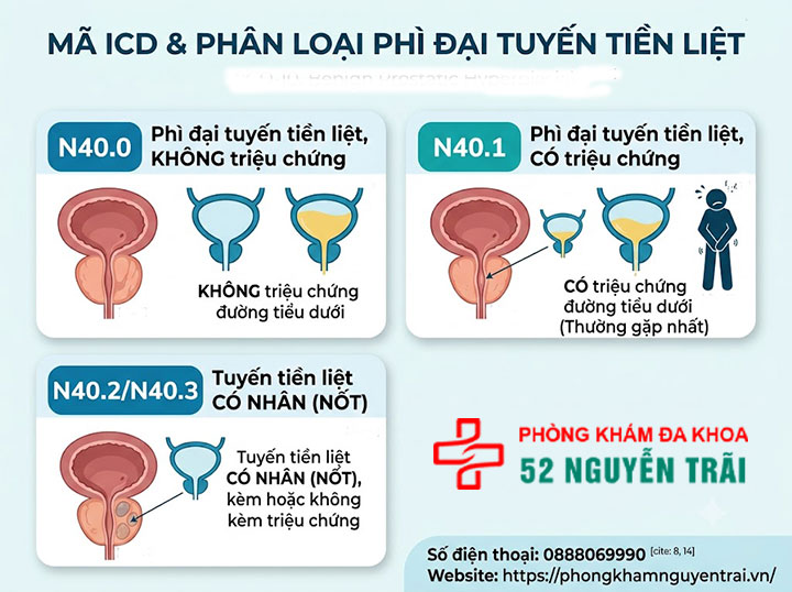 Chẩn đoán phì đại tuyến tiền liệt: Siêu âm, xét nghiệm 6 Mã ICD và phân loại bệnh