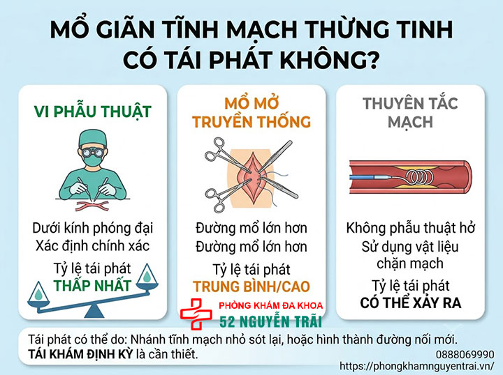 Kết Quả Sau Mổ Giãn Tĩnh Mạch Thừng Tinh: Bao Lâu Có Con? 4 Mổ giãn tĩnh mạch thừng tinh có tái phát không?