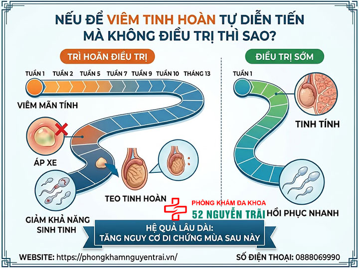 Viêm Tinh Hoàn Bao Lâu Thì Khỏi? Có Tự Khỏi Không? 8 Nếu Để Viêm Tinh Hoàn Tự Diễn Tiến Mà Không Điều Trị Thì Sao?