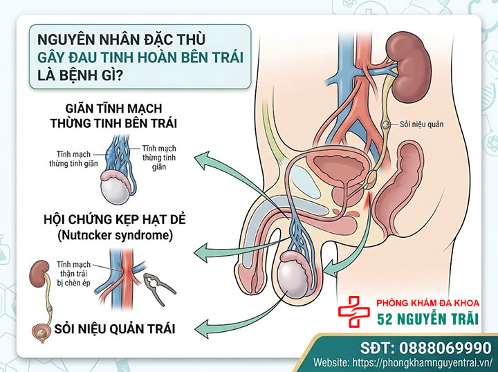 Đau Tinh Hoàn Bên Trái: Nguyên Nhân Và Cách Điều Trị 2 Nguyên nhân đặc thù gây đau tinh hoàn bên trái là bệnh gì?