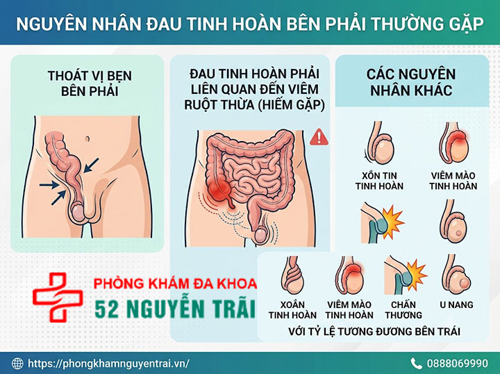 Nguyên Nhân Đau Tinh Hoàn Bên Trái Và Bên Phải 4 Nguyên nhân đau tinh hoàn bên phải thường gặp