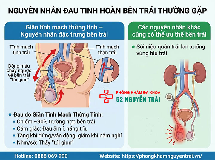 Nguyên Nhân Đau Tinh Hoàn Bên Trái Và Bên Phải 2 Nguyên nhân đau tinh hoàn bên trái thường gặp