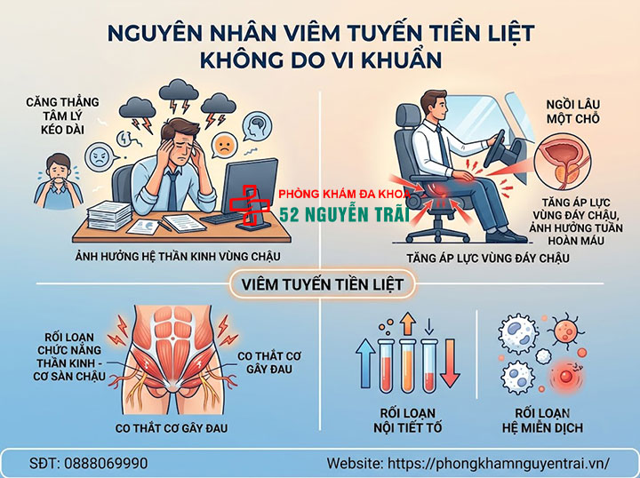 Nguyên nhân gây viêm tuyến tiền liệt ở nam giới 2 Nguyên nhân gây viêm tuyến tiền liệt không do vi khuẩn: Stress, ngồi lâu