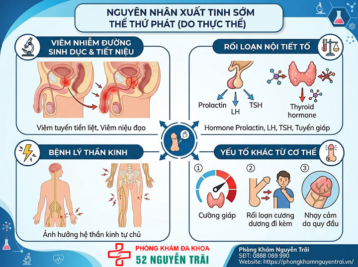 Nguyên nhân xuất tinh sớm và cách khắc phục chi tiết 2 Nguyên nhân xuất tinh sớm do thực thể