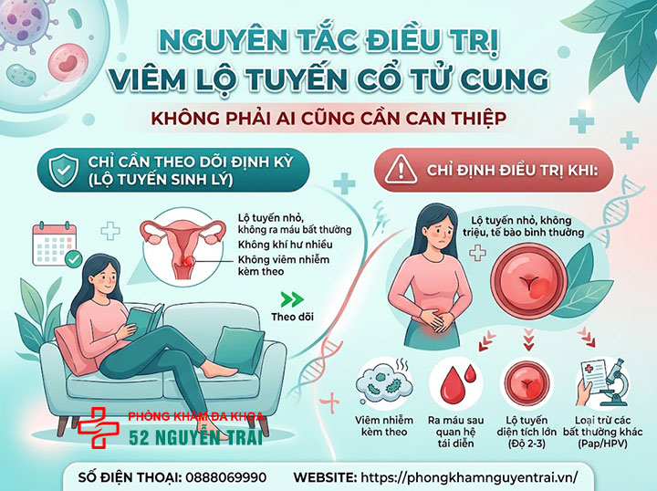 Điều Trị Viêm Lộ Tuyến Cổ Tử Cung: Thuốc Và Phác Đồ 1 Nguyên tắc điều trị Viêm Lộ Tuyến Cổ Tử Cung: không phải ai cũng cần can thiệp