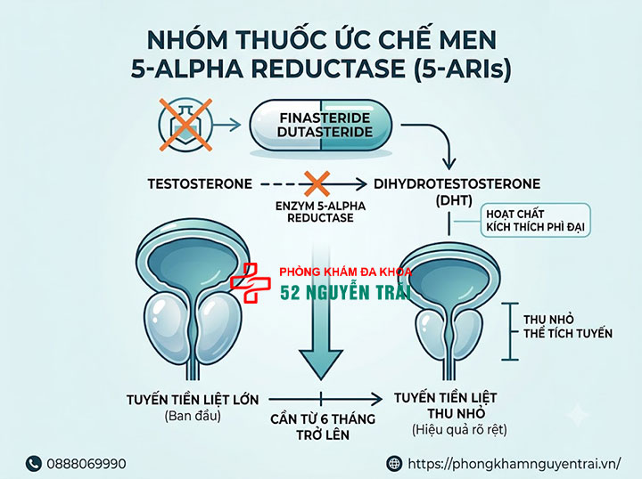 Phì đại tuyến tiền liệt uống thuốc gì? Giải đáp chi tiết 3 Nhóm thuốc ức chế men 5-alpha reductase (5-ARIs)