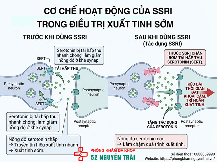 Cách chữa xuất tinh sớm: Phác đồ và thuốc hiệu quả 2 Nhóm ức chế tái hấp thu serotonin chọn lọc (SSRI)