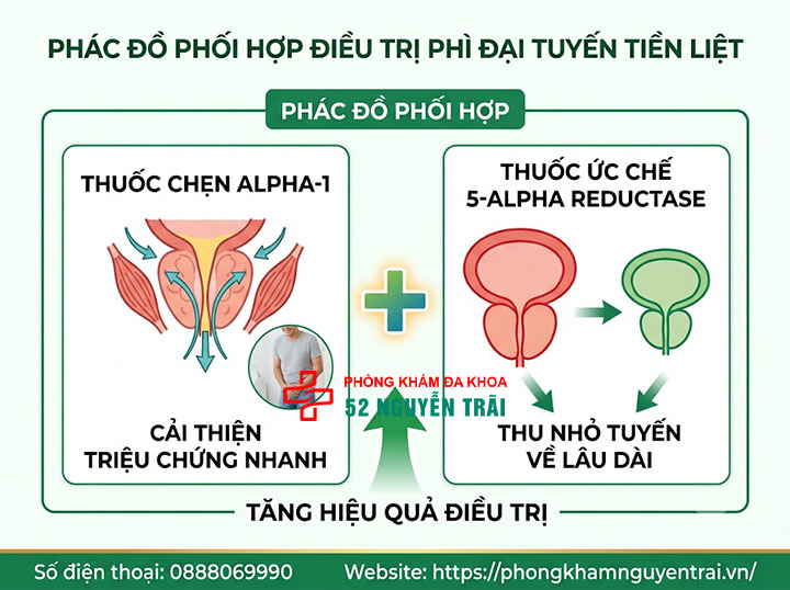 Phì đại tuyến tiền liệt uống thuốc gì? Giải đáp chi tiết 4 Phác đồ phối hợp điều trị phì đại tuyến tiền liệt