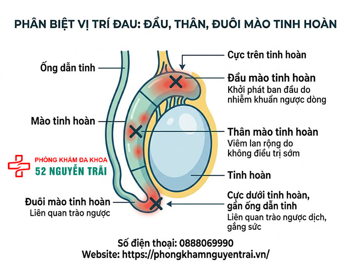 Triệu Chứng Viêm Mào Tinh Hoàn Trái, Phải Cần Biết 7 Phân Biệt Vị Trí Đau: Đầu, Thân, Đuôi Mào Tinh Hoàn