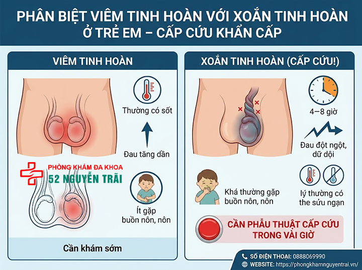 Viêm Tinh Hoàn Ở Trẻ Em Và Trẻ Sơ Sinh: Cha Mẹ Cần Biết 6 Phân Biệt Viêm Tinh Hoàn Với Xoắn Tinh Hoàn Ở Trẻ Em – Cấp Cứu Khẩn Cấp