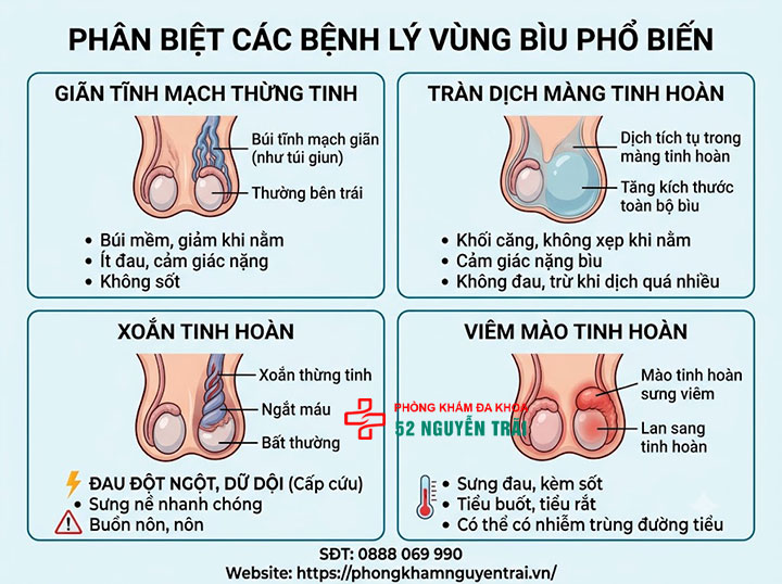 Dấu Hiệu Giãn Tĩnh Mạch Thừng Tinh Cần Nhận Biết Sớm 5 Phân biệt với các bệnh lý bìu khác