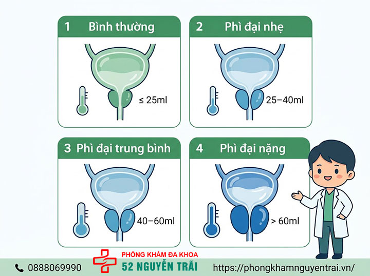 Chẩn đoán phì đại tuyến tiền liệt: Siêu âm, xét nghiệm 5 Phân độ, kích thước tuyến tiền liệt qua siêu âm